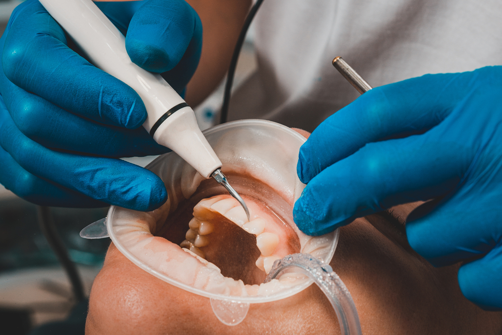 IV Sedation