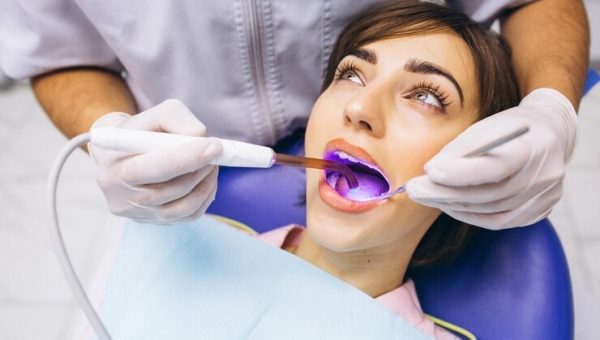 Composite-Fillings-1 Composite-Fillings-1