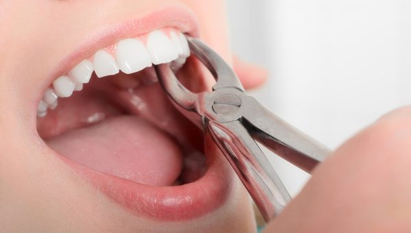 Removing,The,Sick,Tooth,From,Girls,Mouth