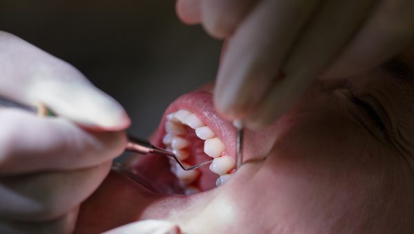 Patient,At,Dentists,Office,,Getting,Soft-tissue,Probed,And,Teeth,Cleaned Patient,At,Dentists,Office,,Getting,Soft-tissue,Probed,And,Teeth,Cleaned