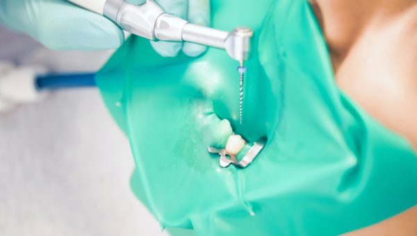Treatment,Of,Dental,Canals,In,The,Bottom,Molar,Permanent,Molar Treatment,Of,Dental,Canals,In,The,Bottom,Molar,Permanent,Molar