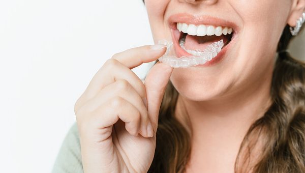 Woman,Smiles,Brightly,As,She,Inserts,A,Clear,Teeth,Aligner Woman,Smiles,Brightly,As,She,Inserts,A,Clear,Teeth,Aligner